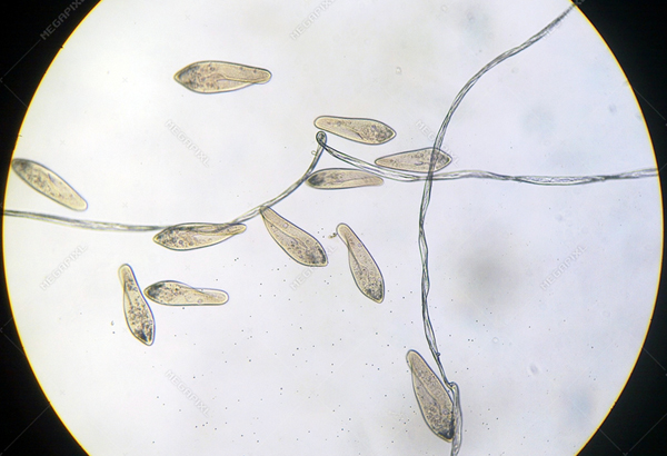 paramecium photo